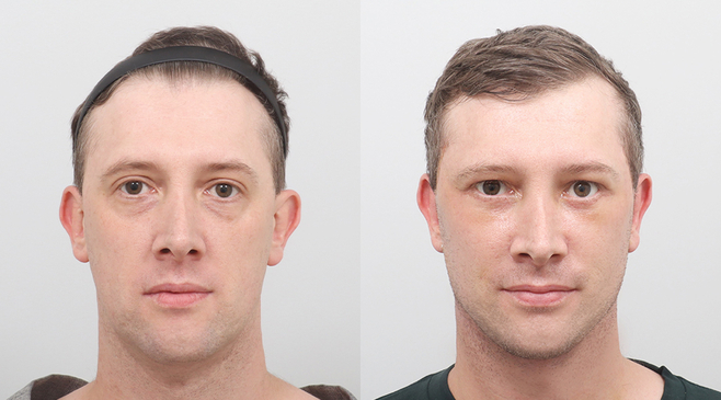 Slider image (2) AB Plastic Surgery